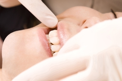  守山市の歯医者　歯科　セラミック治療