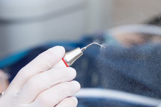 守山市　歯医者ホワイトニング