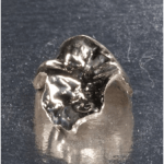  守山市歯医者　ゴールド　