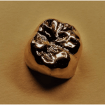  守山市歯医者　歯科　ゴールド