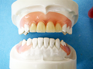  守山市歯医者　歯科　見えない入れ歯