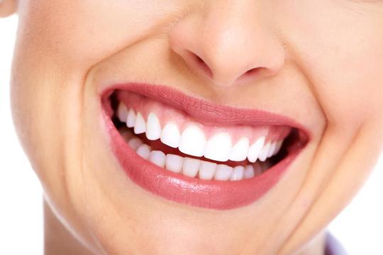  守山市の歯医者　歯科　ホワイトニング