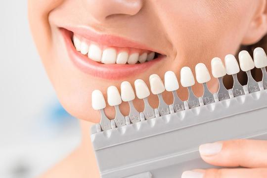  守山市の歯医者　ホワイトニング