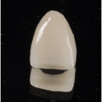  守山市歯医者　歯科　　被せもの