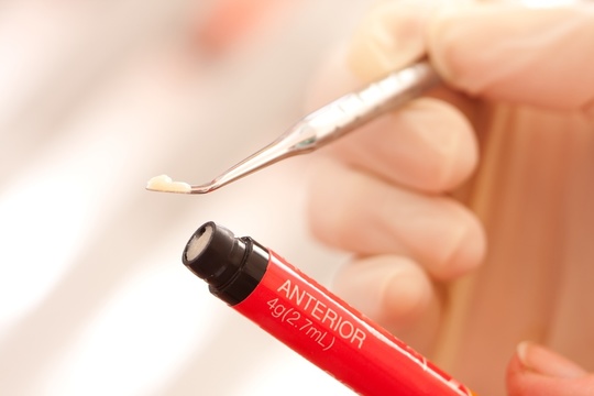 コンポジットレジン　 守山市の歯医者虫歯治療