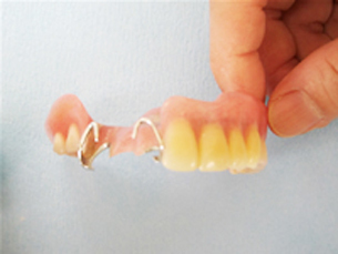  守山市の歯医者　歯科　入れ歯