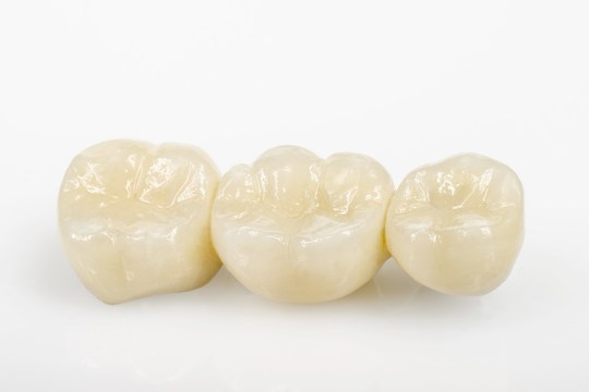  守山市の歯医者　歯科セラミック