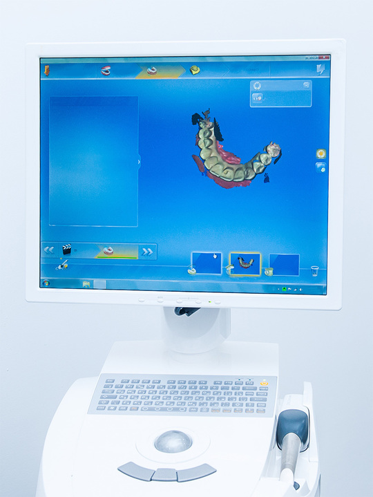  守山市の歯医者　口腔内スキャナー