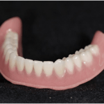  守山市の歯医者　歯科　入れ歯