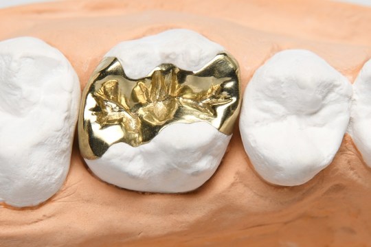  守山市の歯医者　歯科 ゴールド