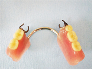  守山市の歯医者　歯科　入れ歯